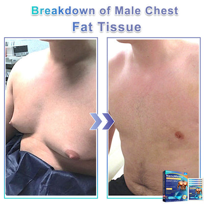🔥GFOUK® NanoMedix Gynecomastia Chest Fatburn & Firm Patch