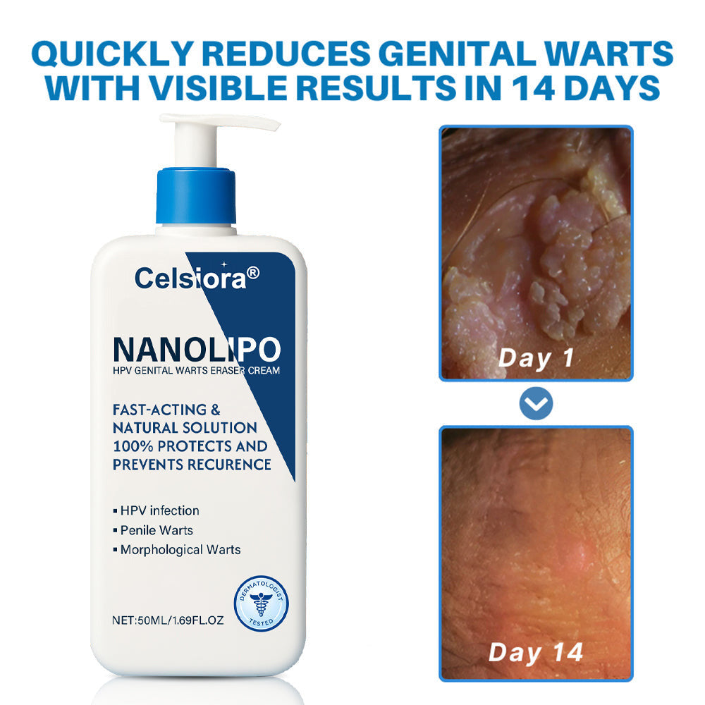 Celsiora® 👨🏻‍⚕️💙NanoLipo HPV Genital Warts Eraser Cream Plus+