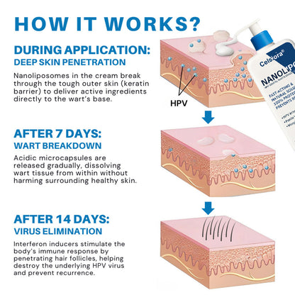 Celsiora® 👨🏻‍⚕️💙NanoLipo HPV Genital Warts Eraser Cream Plus+
