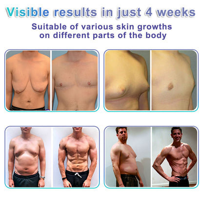 ⚕️GFOUK® NanoMedix Gynecomastia Chest Fatburn & Firm Patch