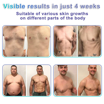 ⚕️GFOUK® NanoMedix Gynecomastia Chest Fatburn & Firm Patch