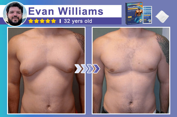 GFOUK® NanoMedix Gynecomastia Chest Fatburn & Firm Patch