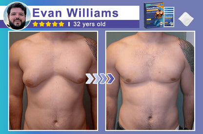 GFOUK® NanoMedix Gynecomastia Chest Fatburn & Firm Patch